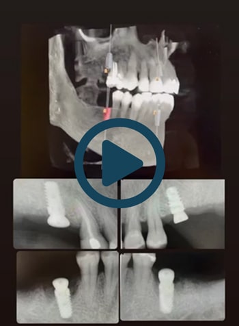 Video x-rays thumbail